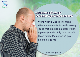 Viêm xoang cấp là gì? Nguyên nhân, triệu chứng, Cách điều trị dứt điểm hiệu quả